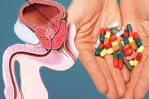 Medicamentos utilizados para tratar a prostatite